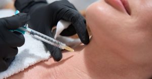 flacidez-en-el-cuello