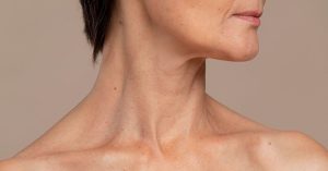 envejecimiento-cuello